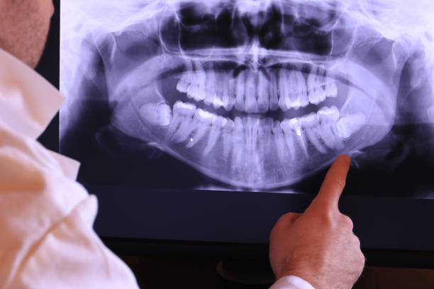 Professional Emergency Dentist in MS