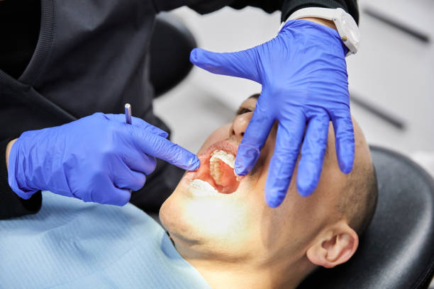 Best Chipped Tooth Repair Near Me  in Water Valley, MS